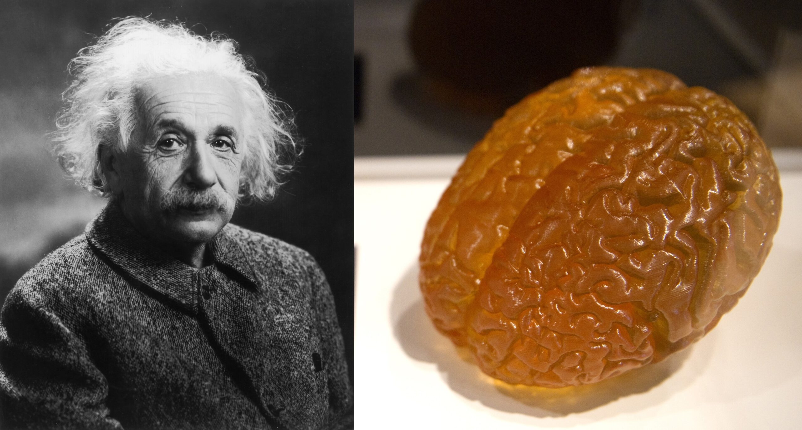 Is Einstein’s Brain Truly Unique Compared to the Average Person?