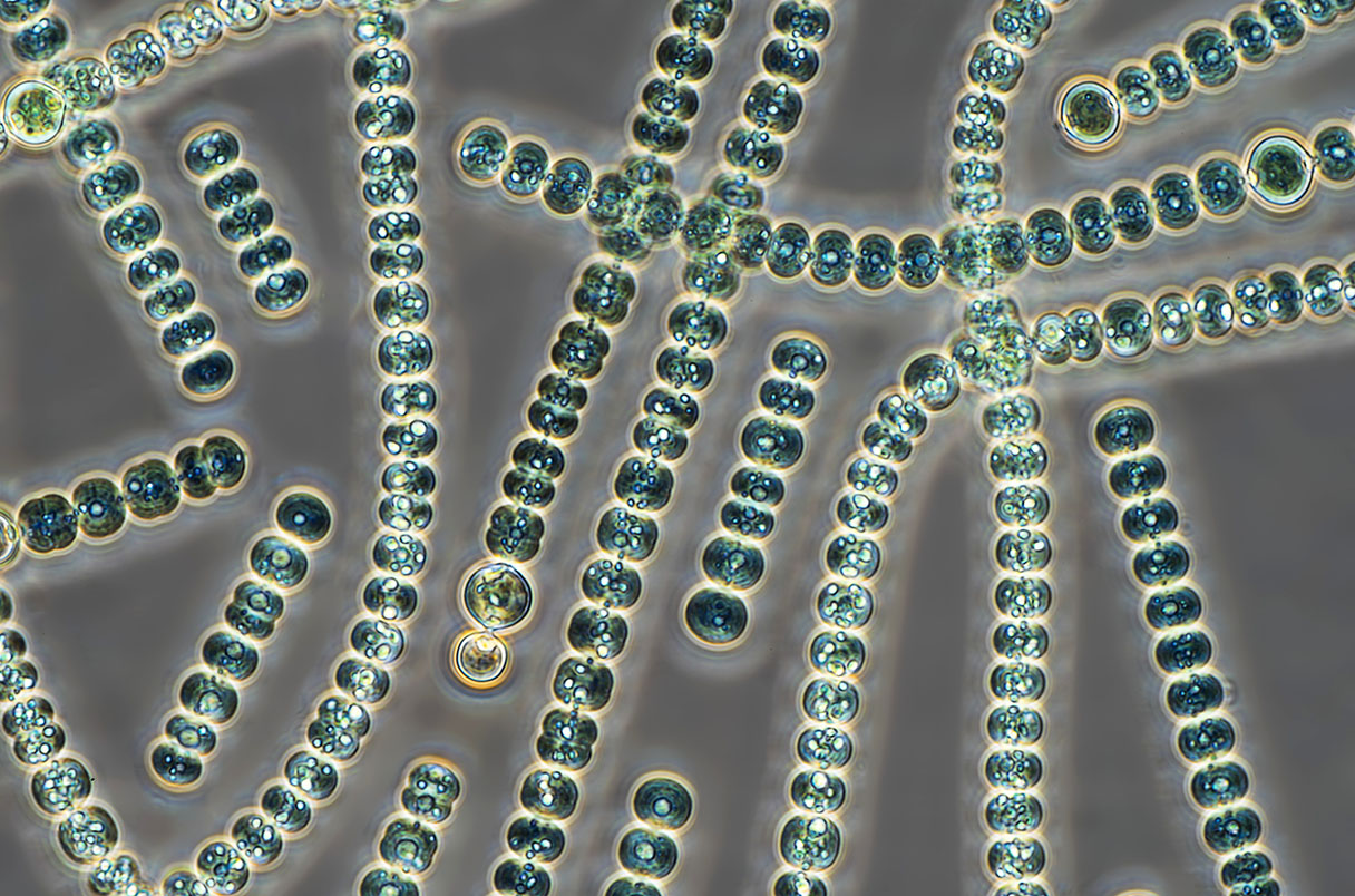 Life on Earth: A Trillion Times More Cells than Sand Grains